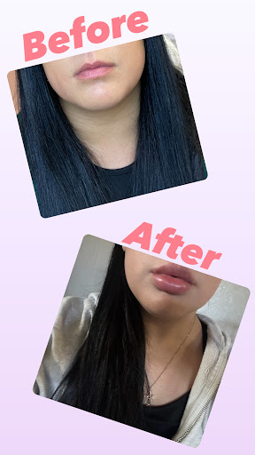 Plump Medspa - Visual