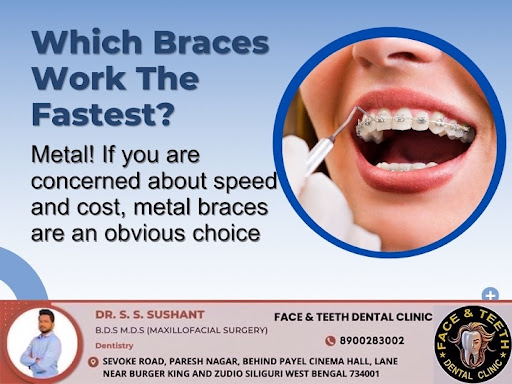 Braces are orthodontic devices used to straighten crooked teeth, close gaps, correct bite problem… post image