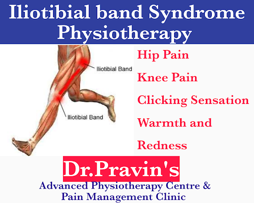 What is iliotibial band syndrome (ITBS)? post image