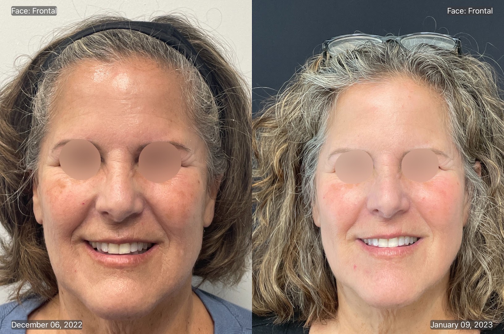 SynergyMD Cosmetic Dermatology photo 15