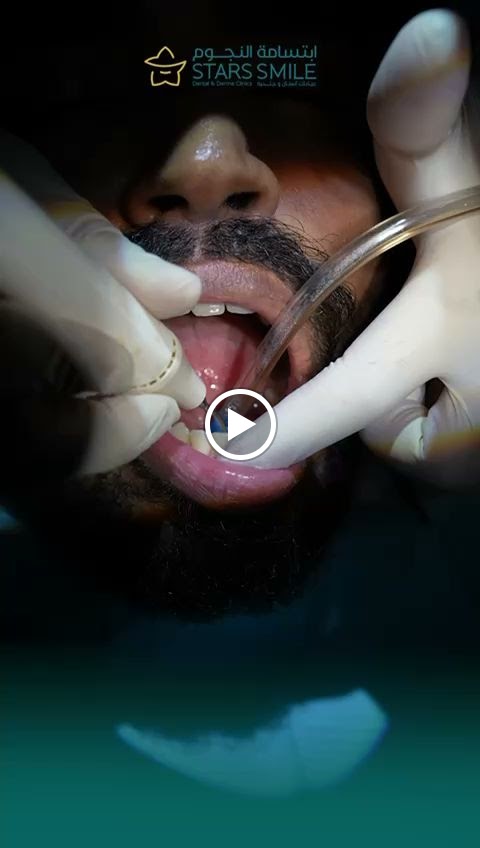 ابتسامه النجوم - صورة 2