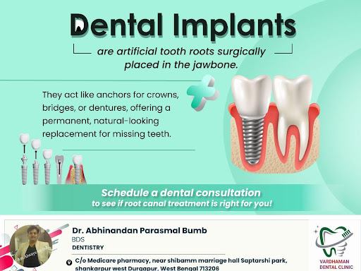 What is a Dental Implant? post image