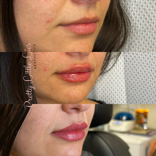 Pretty Little Lies Aesthetics