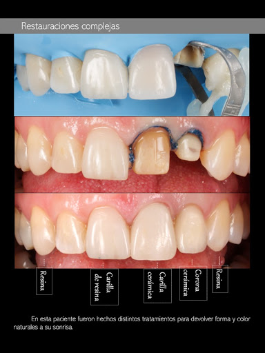 Consultorio Dental. Rehabilitación Oral. - Thumbnail