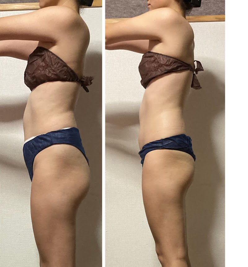 トータルリフレッシュサロン イエラ