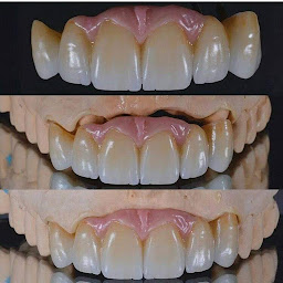 Photo n°24 de Cabinet dentaire dr. BADA et Dr. CORA - Implants/Parodontologie-maladie parodontale/ Orthodontie Invisible/Soins dentaires à Chavanoz (Cabinet dentaire)