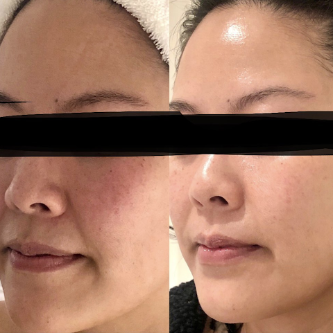 Seattle Facialist by null