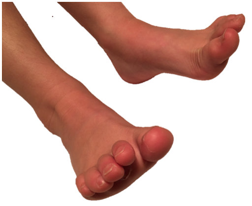 Complete Step - Visual