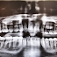 Platinum Touch Oral and Facial Surgery