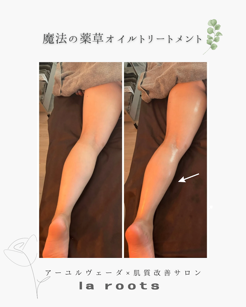 アーユルヴェーダ×肌質改善サロン __la roots