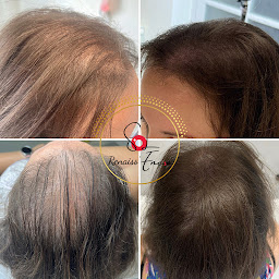 Photo n°13 de Renaiss’Encre à Compiègne (Clinique de maquillage permanent)