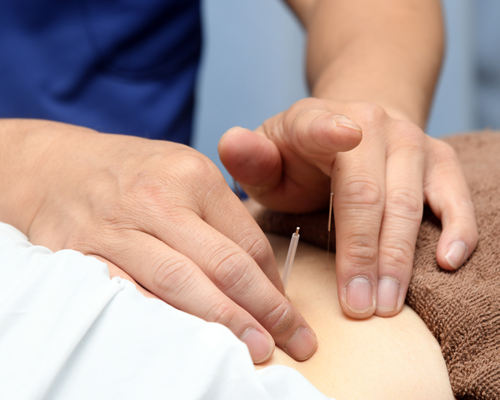 サンテ鍼灸整骨院