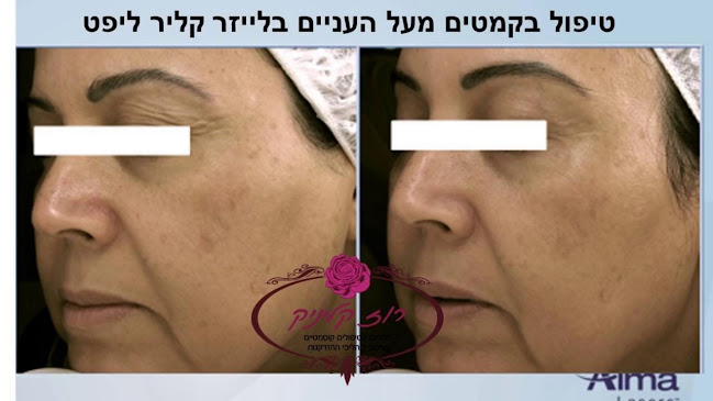 Comentarii opinii despre רוז קליניק - הסרת שיער | טיפולי פנים | הצרת היקפים