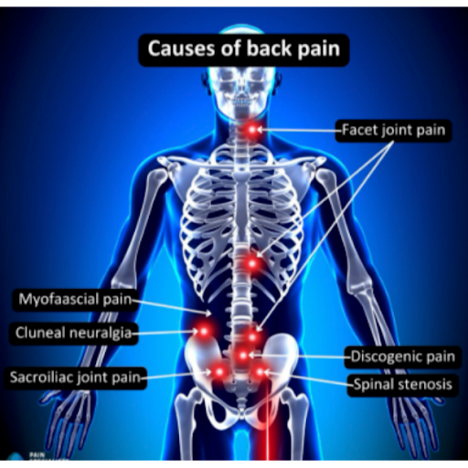 Back pain is one of the most common reasons people visit an orthopaedic surgeon. Whether it's a d… post image