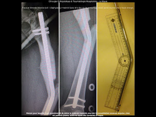 Photo n°16 de Dr Simon Mouchel à Montivilliers (Chirurgien orthopédiste)