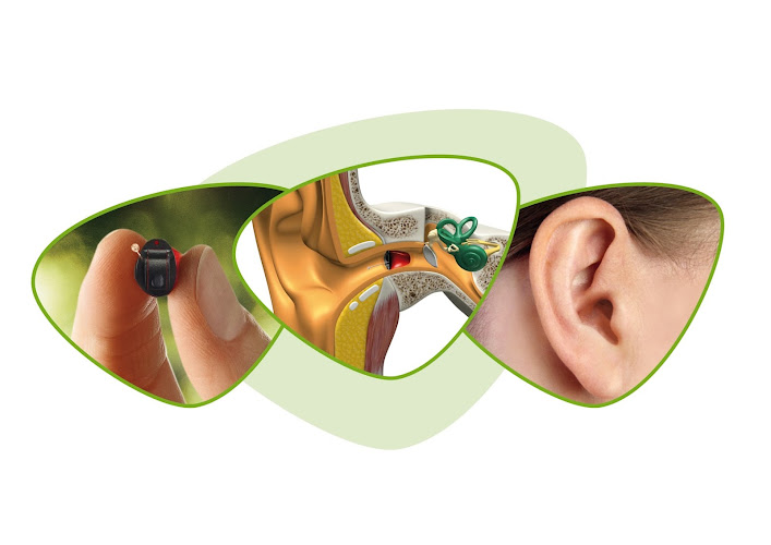 Hörgeräte Ligmann GmbH photo