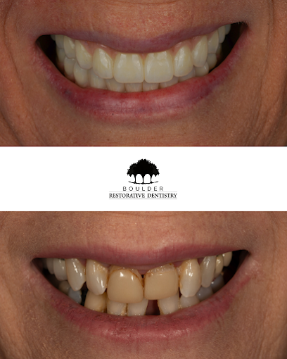 Boulder Restorative Dentistry