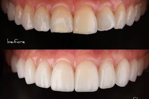 Photo n°22 de Cabinet dentaire de l'Hautil, Dr FISCHER, Dr BLAJMAN, Dr SHAOUL DANAN, Dr WASSERLAUF, Dr SOUSSAN, Dr AMANOU, Dr YORAM DANAN à Carrières-sous-Poissy (Santé)