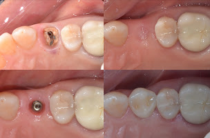 Photo n°12 de Dr L.MIMOUNE-Dentiste Paris 17 à Paris (Dentiste)