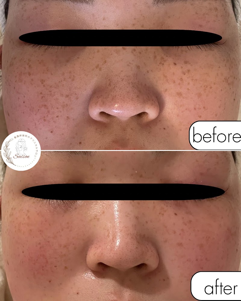 看護師施術のクリニカルサロン Saison