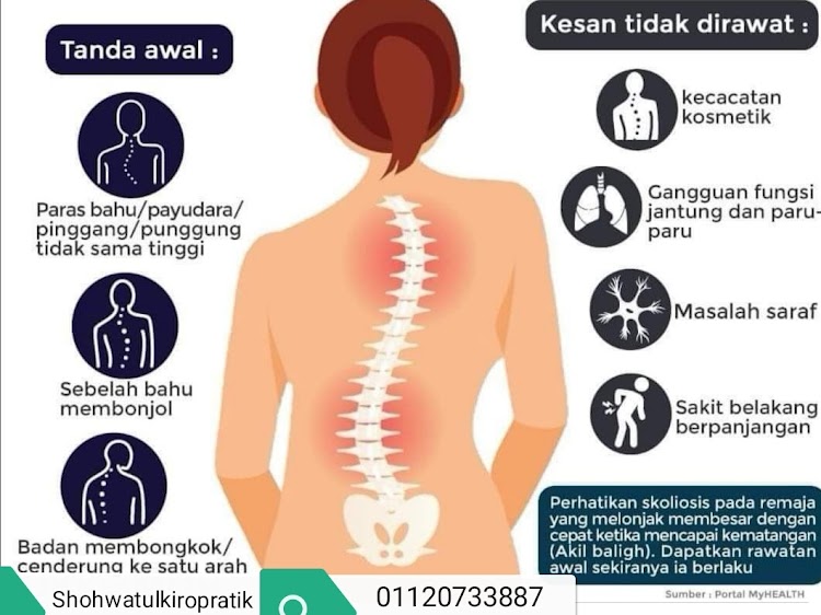 Kebaikkan Urutan Bahagian Tulang Belakang