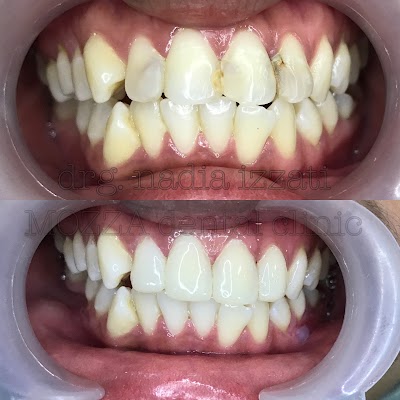 Photos of MOZZA dental clinic