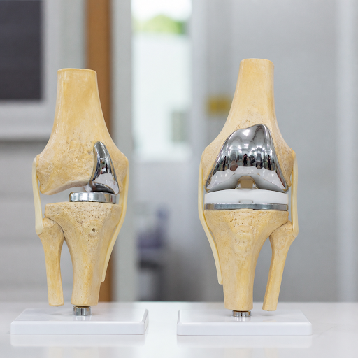 If knee pain is limiting your daily life, understanding your treatment options is the first step… post image