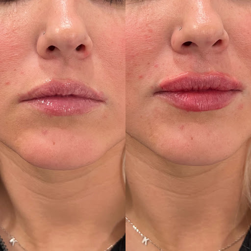 Revived Medical Aesthetics