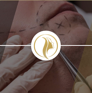 ID Haartransplantationen GmbH - Mannheim