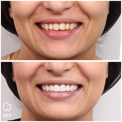 DentoShape Dental clinic Dr. Amgad Hassan Soliman د.أمجد حسن سليمان - صورة 5