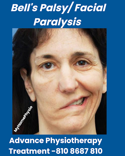 Bell’s Palsy / Facial Paralysis Recovery in Vikhroli – Dr. Pravin’s Advanced Physiotherapy Clinic post image