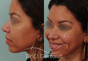 Photo n°8 de Policlinique Esthétique Marigny Vincennes 👃 à Vincennes (Chirurgien)