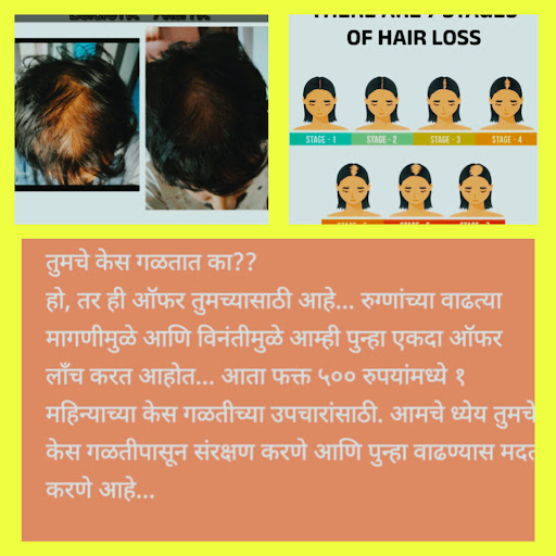Hair Fall Hair regrowth treatment post image