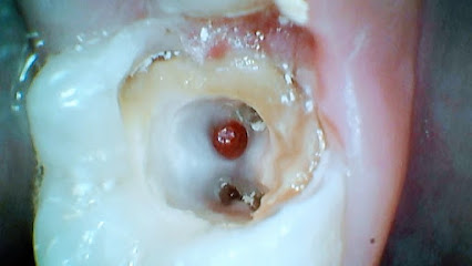 Advance dental health care