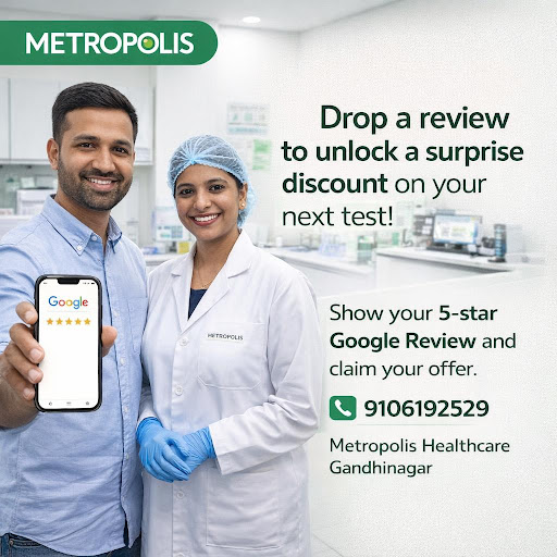 Share Your Review & Get Surprise Offer post image