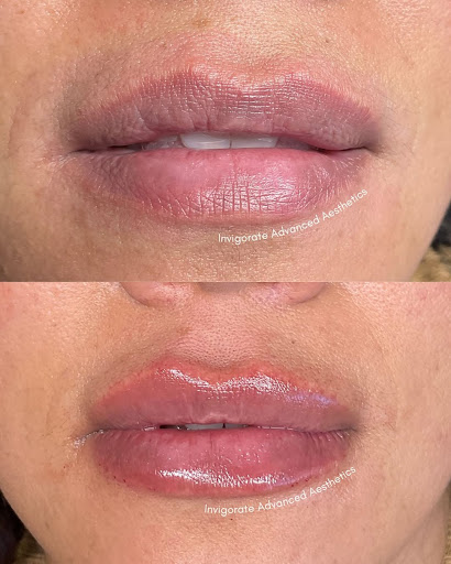 Invigorate Advanced Aesthetics