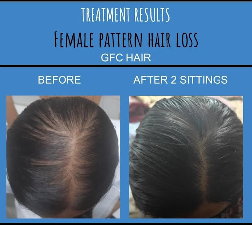 25℅ off on Skin Care Services at COSMO SKIN AND HAIR CARE post image