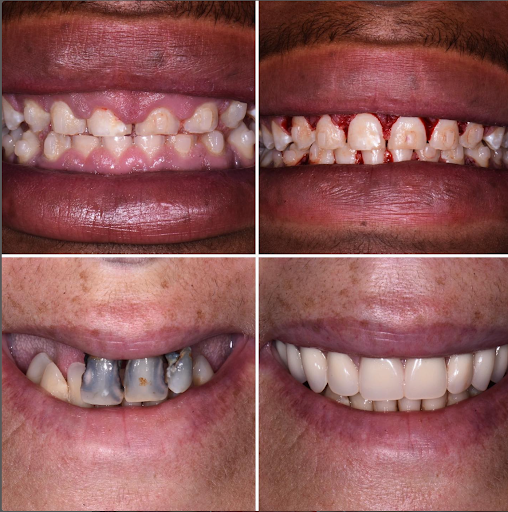 Western Mass Periodontics - Thumbnail