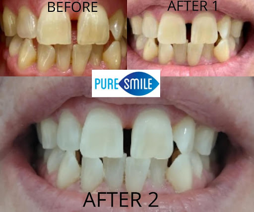 Pure Smile Townsville
