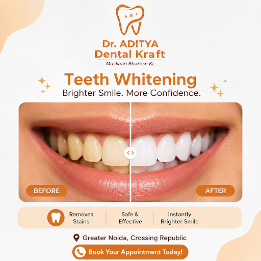 Have you ever looked at an old photograph and wondered why your teeth appeared brighter a few yea… post image