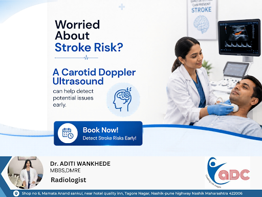 A Carotid Doppler Ultrasound helps identify potential stroke risks, offering early detection for…