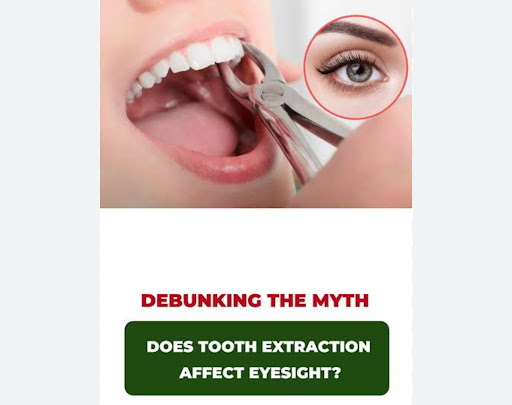Many patients worry that tooth extraction can affect eyesight, but this is a common myth. In rout…