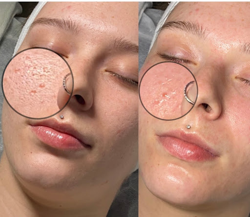 Honest Beauty LLC