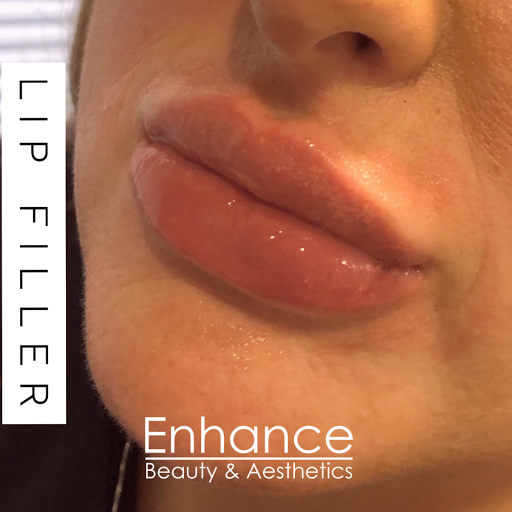 Enhance Clinic UK - Thumbnail