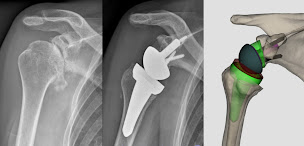 Photo n°8 de Dr Amaury d'Utruy à Versailles (Chirurgien de la main)