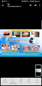 Aesthetic Dental - Implantes Dentales 0