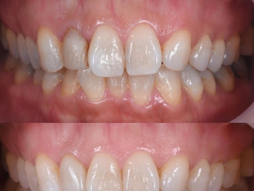 Best Dental Care Clinic in Kankarbagh Patna