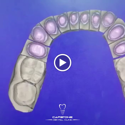 CAPSTONE DENTAL CLINIC - صورة 7