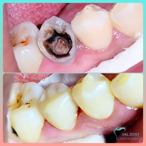 Consultorio dental ''Val Dent'' - Thumbnail