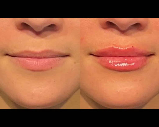 Fresh Faces RX | Advanced Aesthetics in Portland | Dr Jodee M Anderson MD